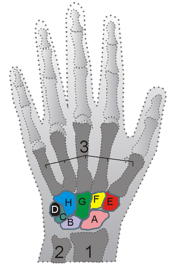 Lunate Wrist