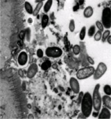 gut wall with commensal bacteria