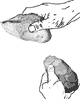 knapping